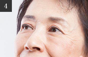 眼瞼下垂など瞼の手術も対応
